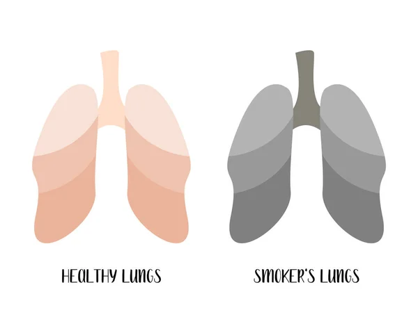 健康的肺和吸烟者的肺 肺病学 矢量平面卡通画 完美的横幅 医疗手册 — 图库矢量图片