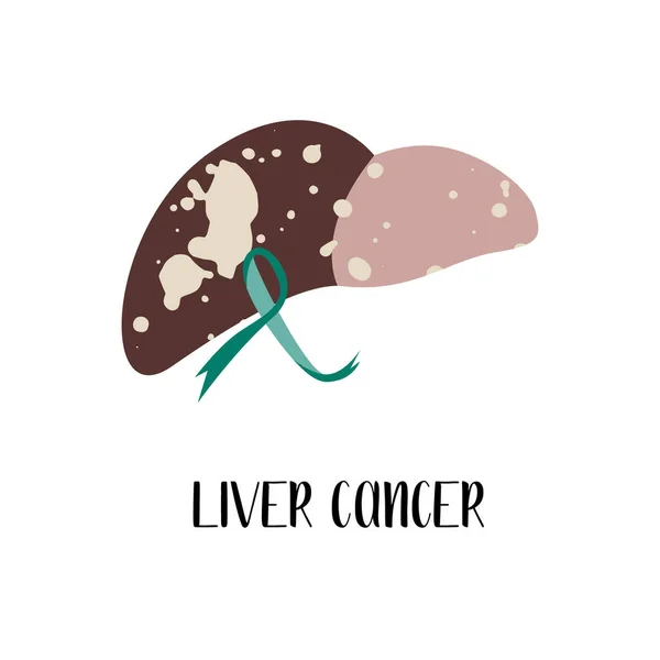 Levercancer Cancer Smaragdmedvetandeband Vektor Platt Illustration Isolerad Vitt — Stock vektor