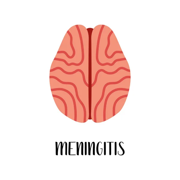 Meningitis Enfermedades Cerebrales Neurobiología Ilustración Plana Vectorial Perfecto Para Volante — Archivo Imágenes Vectoriales