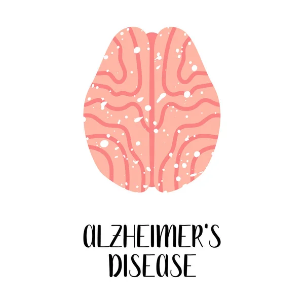 Alzheimer Disease Brain Diseases Neurobiology Vector Flat Illustration Perfect Flyer — Stock Vector