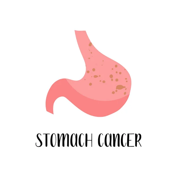 Magcancer Magcancer Onkologi Magsjuka Gastroenterologi Vektor Platt Illustration Perfekt För — Stock vektor