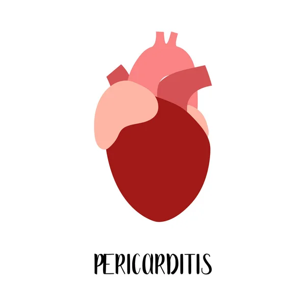 Pericardite Cuore Malattie Cardiovascolari Cardiologia Illustrazione Piatta Vettoriale Flyer Brochure — Vettoriale Stock