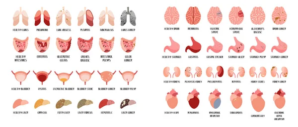 Healthy and unhealthy internal human organs. Brain, lungs, liver, heart, stomach, intestines, kidneys, bladder. Different diseases. Vector flat illustration. For flyer, medical brochure, banner — Stock Illustration Healthy Unhealthy Internal Human Organs Brain Lungs Liver Heart Stomach Vector Graphics