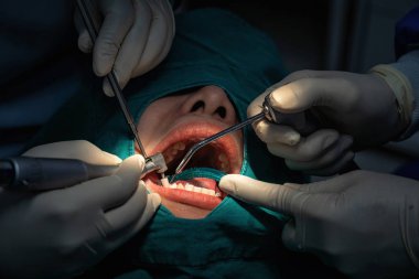 Diş kliniğinde diş hekimi ve diş temizliği için asistan, Diş bakım konsepti.