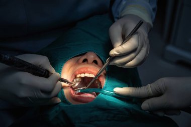Diş kliniğinde diş hekimi ve diş temizliği için asistan, Diş bakım konsepti.