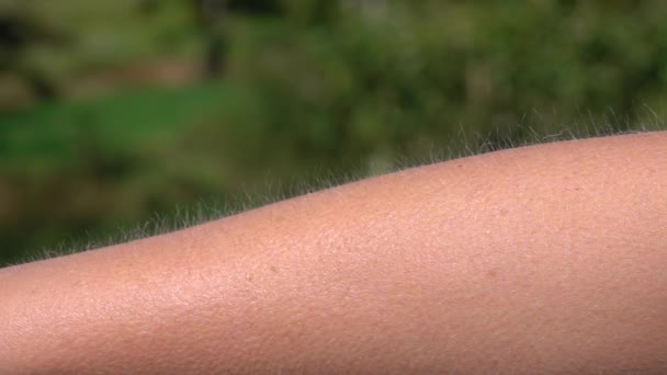 Nahaufnahme Makroschärfentiefe Detail Von Haut Und Haaren Mit Gänsehaut Auf — Stockvideo