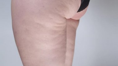 Yavaş Hareket, Close Up: siyah iç çamaşırı tanınamayan kadın hareketsiz duruyor. Bilinmeyen kadın onun iç çamaşırı ayakta tarafından uyluk ve kalça üzerinde selülit ifşa. Ciddi sağlık durumu.