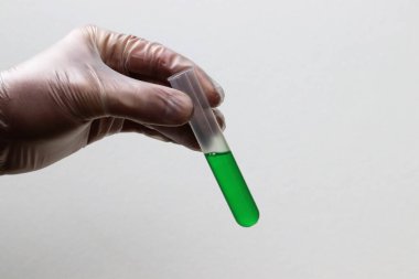 Elinde yeşil sıvı test tüpü tutan laboratuvar eldiveni var.