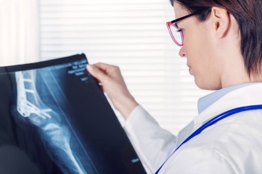 Kadın genç doktor veya radyolog ofisinde ışığa tutarak bir x-ray ile