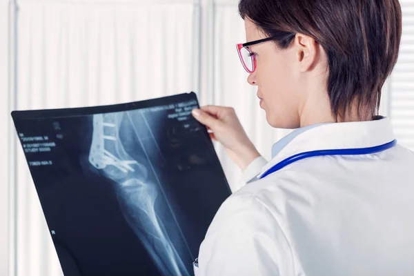 Doctora Radióloga Joven Con Una Radiografía Que Sostiene Hasta Luz — Foto de Stock