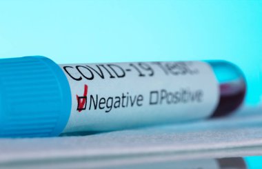 Kan örneğiyle test tüpünün makro fotoğrafı. Mavi arkaplandaki Coperid-19 testi negatif..