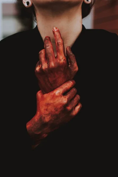 一只红肿的雌性手在疼痛中的垂直特写镜头 — 图库照片