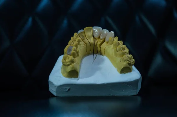 Widok Sztucznej Szczęki Pokazującej Zęby Podstawce Ciemnym Tłem — Zdjęcie stockowe
