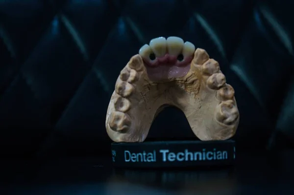 Вид Искусственной Челюсти Показывающей Зубы Подставке Темным Фоном — стоковое фото