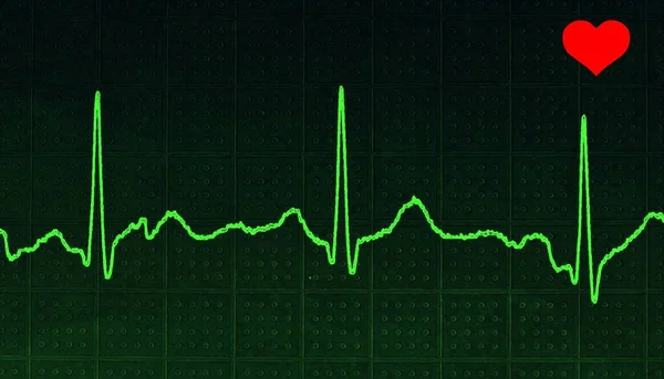 Ein Kardiogramm Isoliert Auf Einem Grünen Quadratisch Gemusterten Hintergrund — Stockfoto