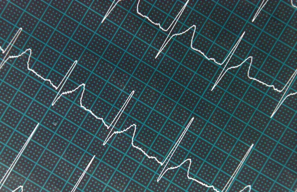Illustration Der Zeilen Die Den Herzschlag Auf Einem Herzmonitor Zeigen — Stockfoto