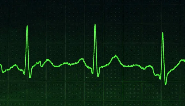 Illustration Einer Grünen Linie Des Elektrokardiographischen Diagramms Auf Dunklem Hintergrund — Stockfoto