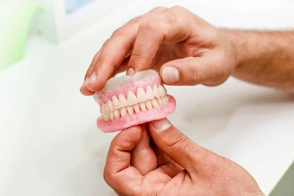 Τεχνητά Δόντια Του Γεμάτο Στόμα Στο Οδοντιατρείο — Φωτογραφία Αρχείου