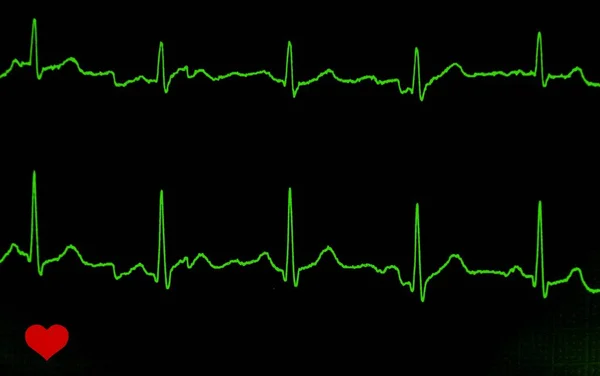 Een Illustratie Van Een Groene Lijn Van Elektrocardiografische Grafiek Een — Stockfoto