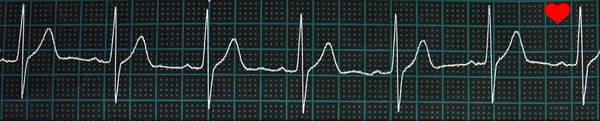 Cardiograma Branco Fundo Forma Quadrado Azul Preto — Fotografia de Stock