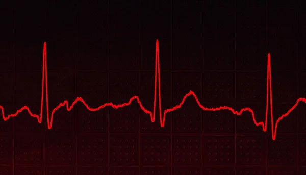 Koyu Kırmızı Arkaplanda Kalp Atışlarını Gösteren Kırmızı Bir Çizginin Çizimi — Stok fotoğraf