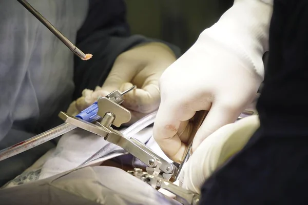 Tiro Close Médicos Realizando Uma Cirurgia Espinhal Sob Luzes Hospital — Fotografia de Stock