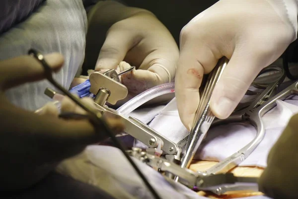 Tiro Close Médicos Realizando Uma Cirurgia Espinhal Sob Luzes Conceito — Fotografia de Stock