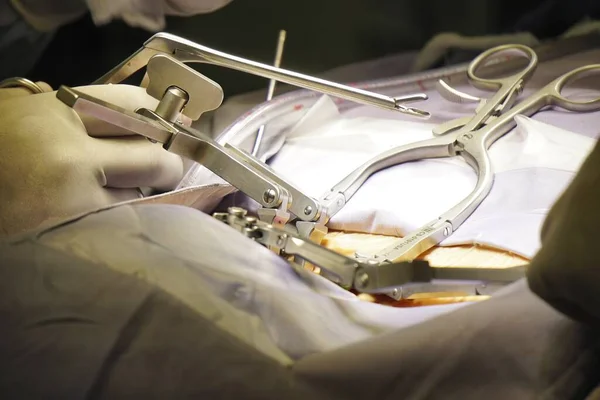 Tiro Close Médicos Realizando Uma Cirurgia Espinhal Sob Luzes Conceito — Fotografia de Stock