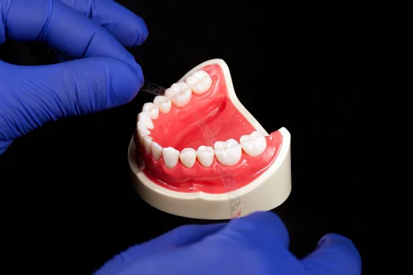 Tiro Ângulo Alto Dentista Trabalhando Modelo Dentário Fundo Preto — Fotografia de Stock