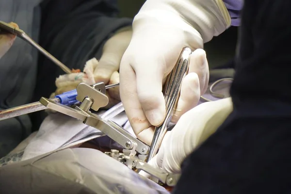 Closeup Shot Doctors Performing Spinal Surgery Lights Surgical Concept — Stock Photo, Image