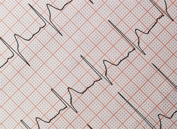 Zbliżenie Ujęcia Elektrokardiogramu Serca — Zdjęcie stockowe