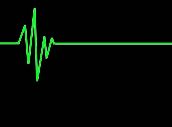 心臓の鼓動を示す緑の線と黒の背景の平線のイラスト — ストック写真