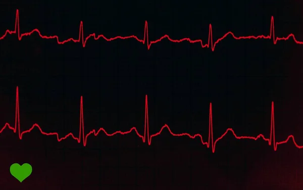 Siyah Bir Arkaplanda Kırmızı Bir Kardiyogram Izole Edilmiş — Stok fotoğraf