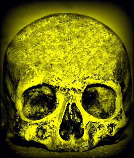 Closeup View Human Skull Captured Yellow Effect Concept Death — Stock Photo, Image