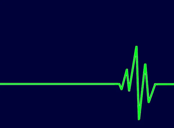 Een Groen Cardiogram Geïsoleerd Een Blauwe Achtergrond — Stockfoto