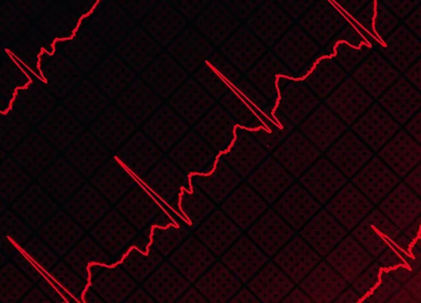 Kalp Atışı Olan Bir Ekg Elektrokardiyogramı — Stok fotoğraf