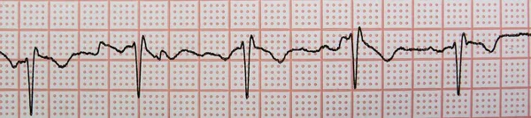 Close Eletrocardiograma — Fotografia de Stock