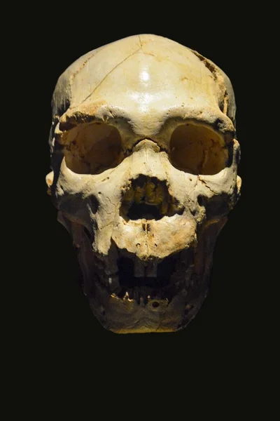 Spain Spain August 2014 Skull Located Museum Spain — 图库照片