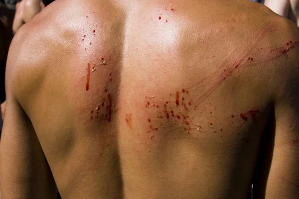 Primer Plano Del Hombre Herido Con Sangre Espalda — Foto de Stock