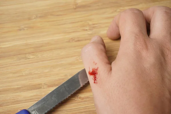 Primer Plano Sangre Goteando Mano Una Persona Sobre Cuchillo — Foto de Stock