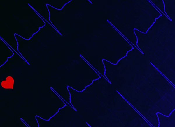 Kardiogram Ekg Szívveréssel — Stock Fotó