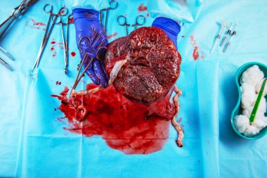 Doğum sırasında plasenta closeup, Ebelik