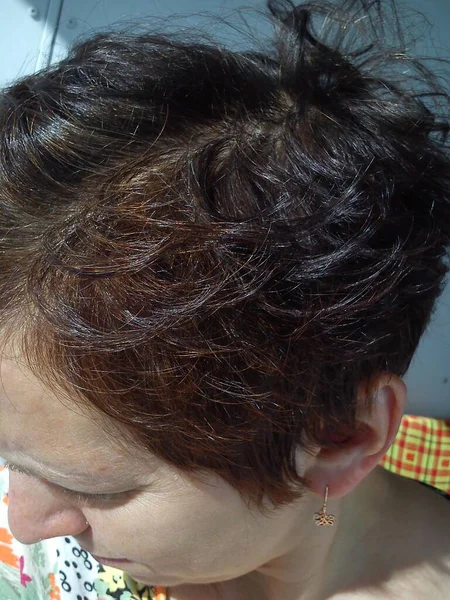 一个中年妇女的头发 在庙宇里染成了灰色 头发问题的短发 三分法作为一门医学学科 Zhenzina是一个从上方拍摄的黑发女人 最初的秃头 — 图库照片