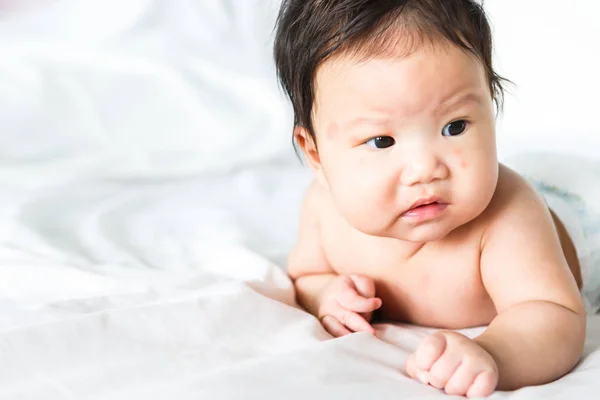 Asiática Bebé Chica Con Rojo Manchas Piel Cara — Foto de Stock