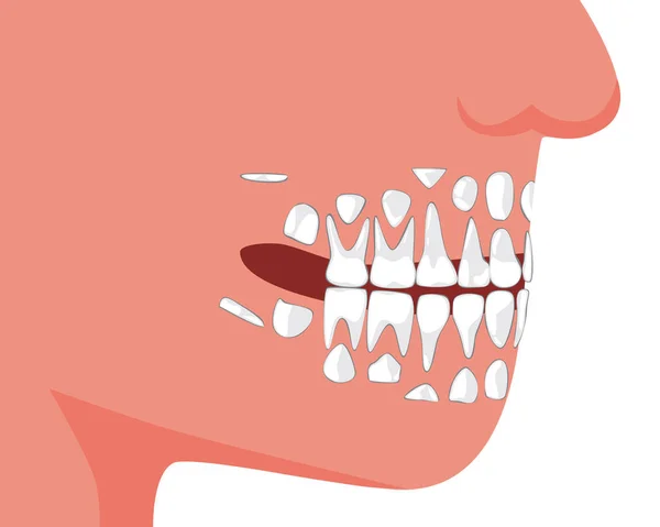 Enfant Personne Avec Des Dents Bébé Croissance Des Dents Permanentes — Image vectorielle