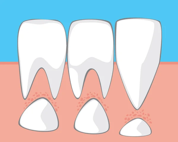 Molares Dientes Leche Niño Durante Cambio Dientes Permanentes Ilustración Del — Vector de stock