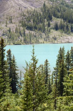 Yay Gölü yaz aylarında bulutlu günde Banff National Park, Alberta, Kanada