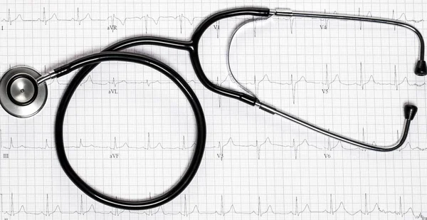 Stéthoscope Forme Battement Cœur Sur Électrocardiogramme — Photo