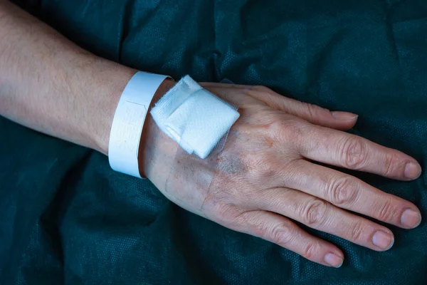 カヌラ マークを持つ病院の患者の手は — ストック写真