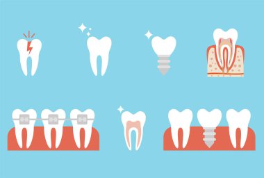 Ortodontik diş telleriyle dişlerin düzeltilmesi. Diş anatomisi vektör diş infographics. Set Sağlık Diş Kavramı Düz Tasarım Stil. Diş yapısı. Diş anatomisi kavramı.